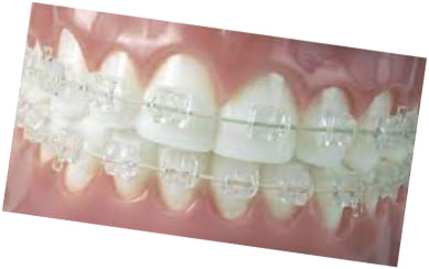 ortodontiya